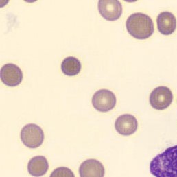 Cell photomicrograph to identify
